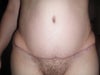 Front view!! Horrible results If not fixed by doctor!!
