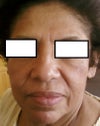 before the surgery