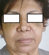 after the surgery