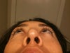 bump inside my left nostril