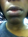 lip