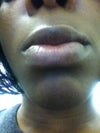 lips