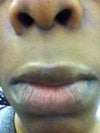 lips