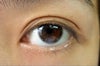 how my eyes look like now, since a month ago. please help!! where did my fatty eyelids go?? I don't look asian at all now!!