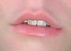 bottom lip droops slightly -- top lip smaller on one side.