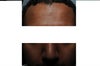 forehead and face