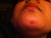 looks very ugly to look at given that I have light colored skin..