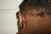Right Ear