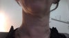 Turkey neck, saggy, crepey skin on 39 year old