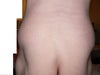 My flanks seem to bulge out.