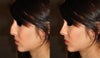 How I would picture my new nose to look...