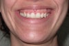 Smile front.