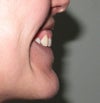 Smile side.