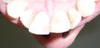 Back of front teeth