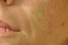 5-6 hrs after, green line indicates new wrinkle