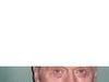 $ weeks post lower blepharoplasty