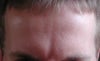 This is me relaxed.. with the deep virtical angry line between my brows that always feels heavy and looks like I'm annoyed about something.. I dont feel or look relaxed even when I am relaxed.