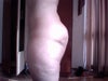 This is the right side of my butt.  It is a bit deeper and longer (sideway)