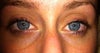 I wasn't kidding when I said they were bad, this is what I deal with. No makeup.