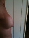 Right breast from side