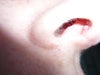 Right Nostril