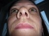 Septum