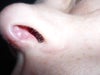 Left Nostril