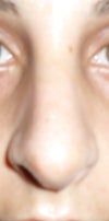 10 days after