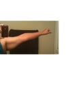 Upper Arms