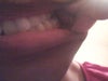 Side Bite Touching