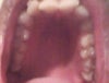 Top Arch