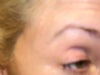 hollow eyes