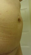 This is were the lump is much noticed