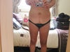 Front view, the scar running down my tummy is from a hysterectomy. The scar on the lower left is from a drain from the surgery
