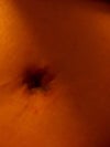 All seem to be on the ring of the belly button.