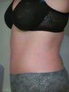 Again, you should be able to see the fatty area if you look closely.