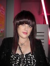 (ignore the hair) this picture shows how the sagging has now given my chin and jaw area a deformed and unnatural look.