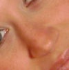 my nose