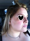 right profile (bad side)