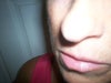 nose tip