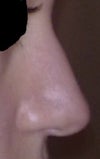 Before- profile
