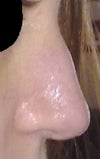 After- profile