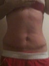 4 weeks post op