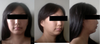 my current chin