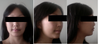 desired change (jaw extended to take these photos)