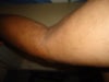 my leg