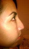 Before surgery