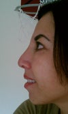 This how my nose looks now :'(