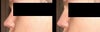 Nosejob photoshop 1