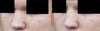 Nosejob photoshop 3